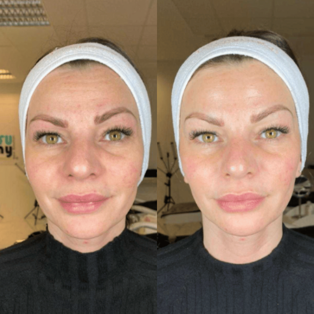Fenrose® Mascarilla Boost de Colágeno