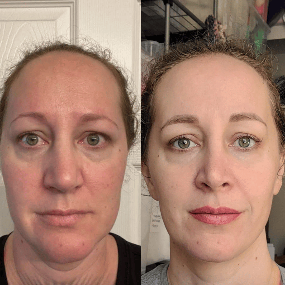 Fenrose® Mascarilla Boost de Colágeno