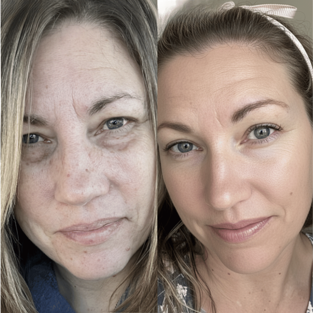 Fenrose® Mascarilla Boost de Colágeno