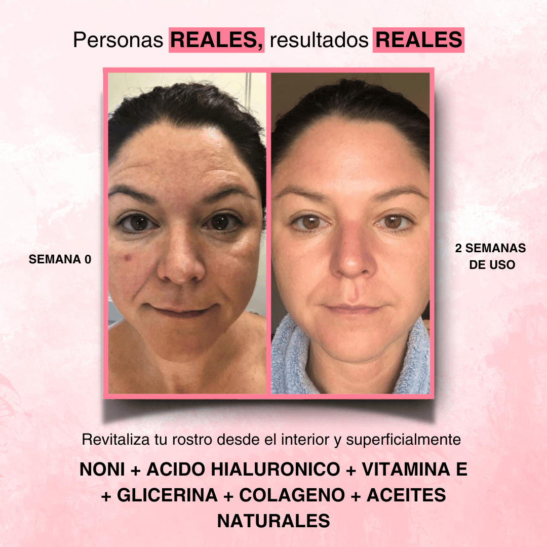 Fenrose® Mascarilla Boost de Colágeno