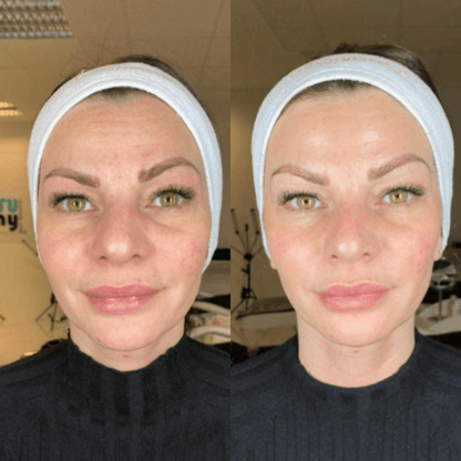 Fenrose® Mascarilla Boost de Colágeno