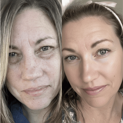 Fenrose® Mascarilla Boost de Colágeno